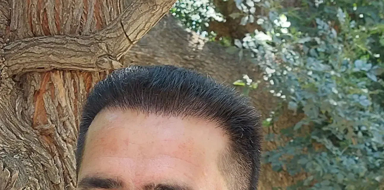 کاشت مو و ابرو قسطی در شیراز|خدمات آرایشگری و زیبایی|شیراز, قصرالدشت|دیوار