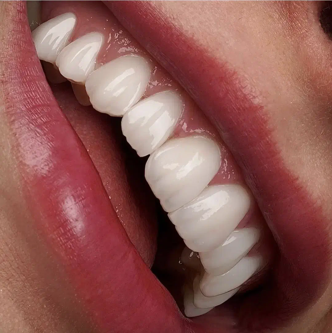 دستیار دندانپزشک خانم|استخدام درمانی، زیبایی، بهداشتی|تهران, پاسداران|دیوار