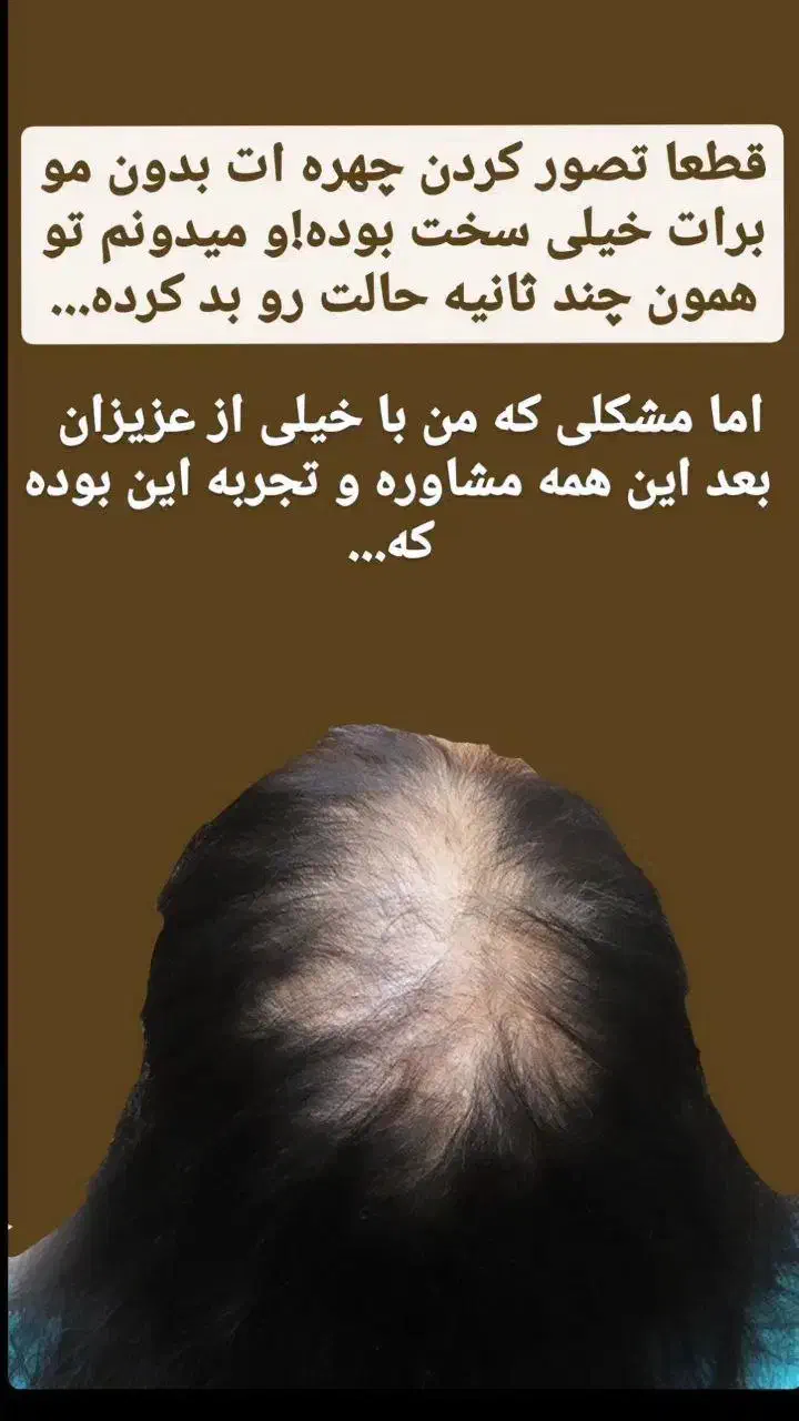 درمان قطعی ریزش مو|آرایشی، بهداشتی، درمانی|اهواز, شهرک نفت|دیوار