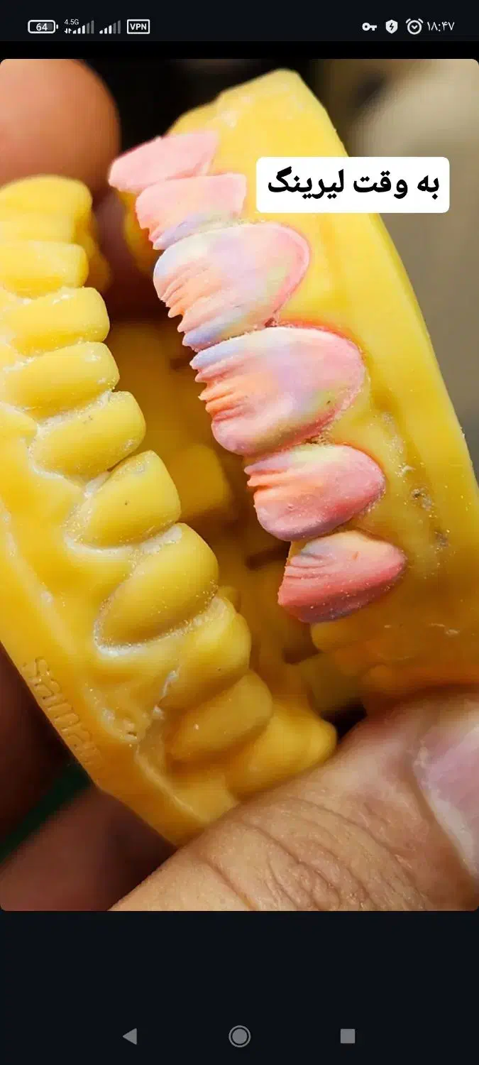 پودرگذار پرسلن نیازمندیم|استخدام درمانی، زیبایی، بهداشتی|نسیم‌شهر, |دیوار