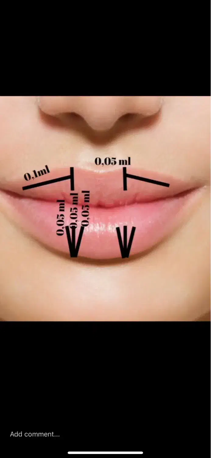آموزش ژل بوتاکس و بادی فقط و فقط۷۹۰۰|خدمات آموزشی|کرج, گوهردشت|دیوار