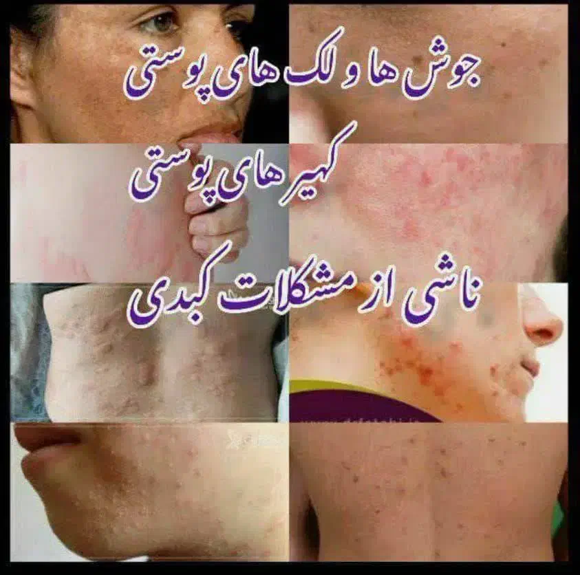 مراقبت پوست|آرایشی، بهداشتی، درمانی|شاهینشهر, شهرک میلاد|دیوار