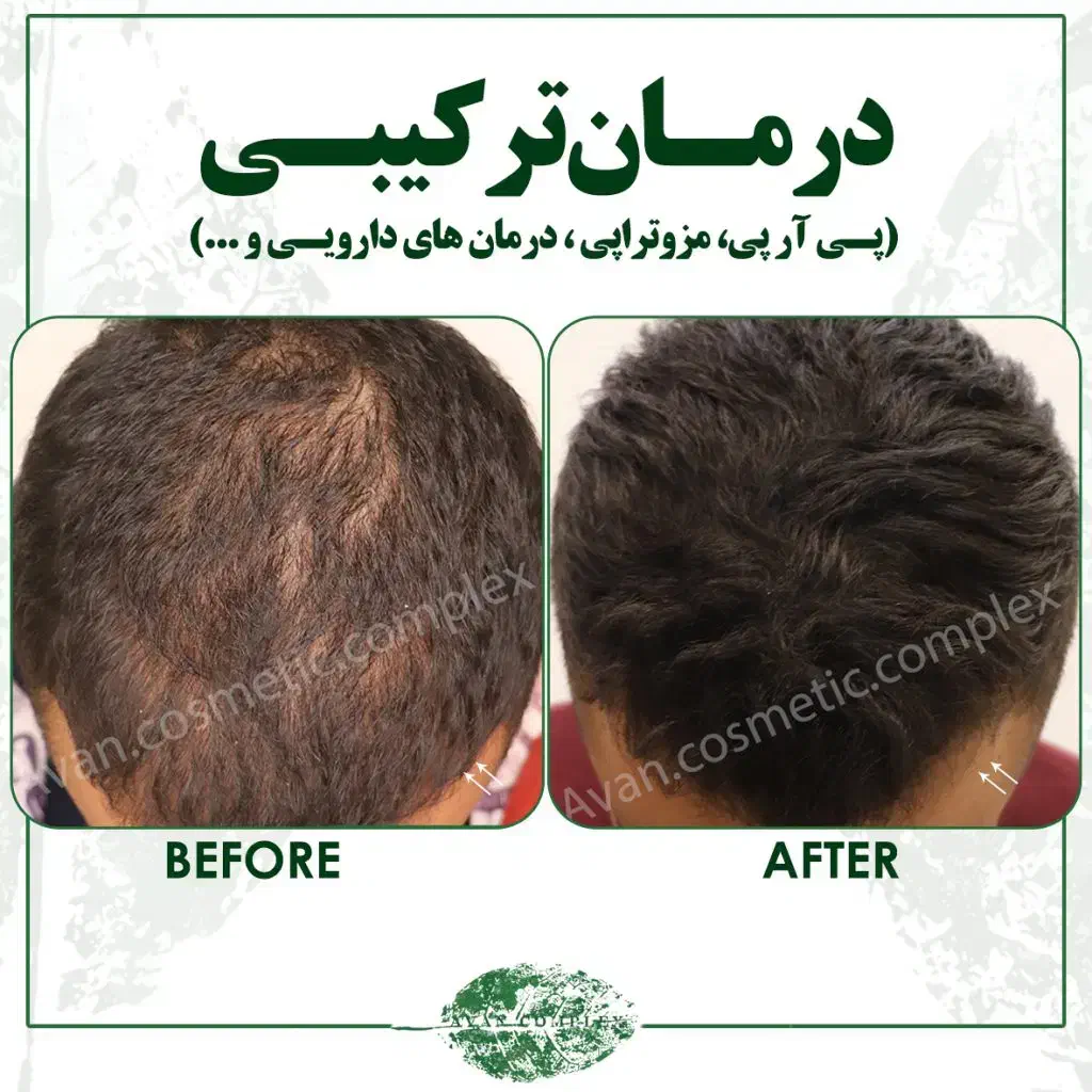 کیلینیک زیبایی (پوست ،مو ،لیزر )|خدمات آرایشگری و زیبایی|اسلام‌شهر, شهرک واوان|دیوار