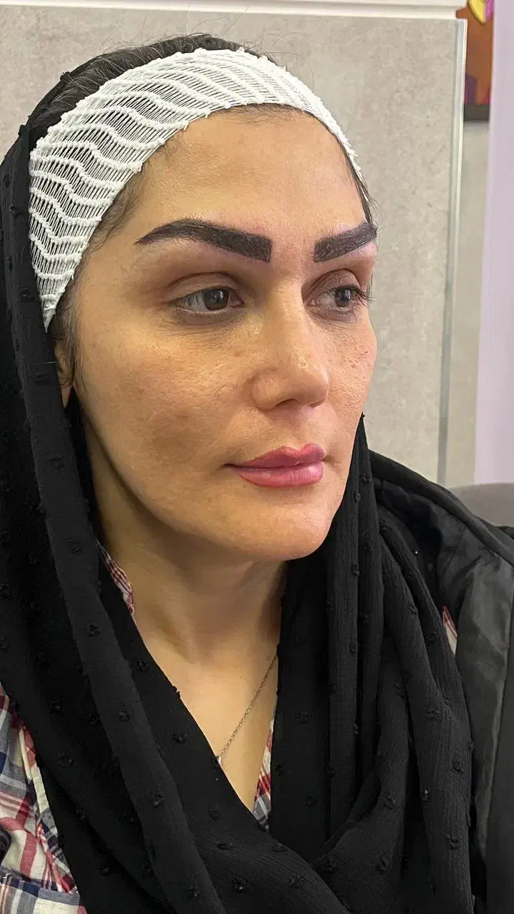 کاشت ابروی مادام العمر در کلینیک تخصصی پوست و مو|خدمات آرایشگری و زیبایی|فولادشهر, C5|دیوار
