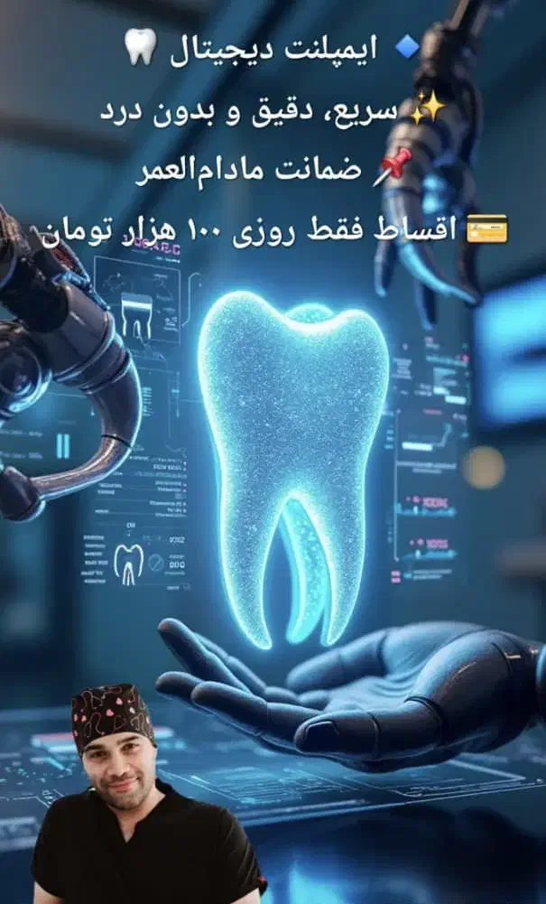 ایمپلنت اقساط با ضمانتنامه مادام العمر|خدمات آرایشگری و زیبایی|تهران, قیطریه|دیوار