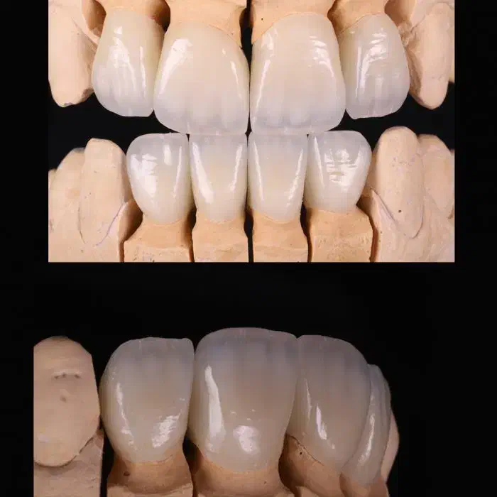 دندانسازی ثابت و متحرک|آرایشی، بهداشتی، درمانی|ارومیه, |دیوار