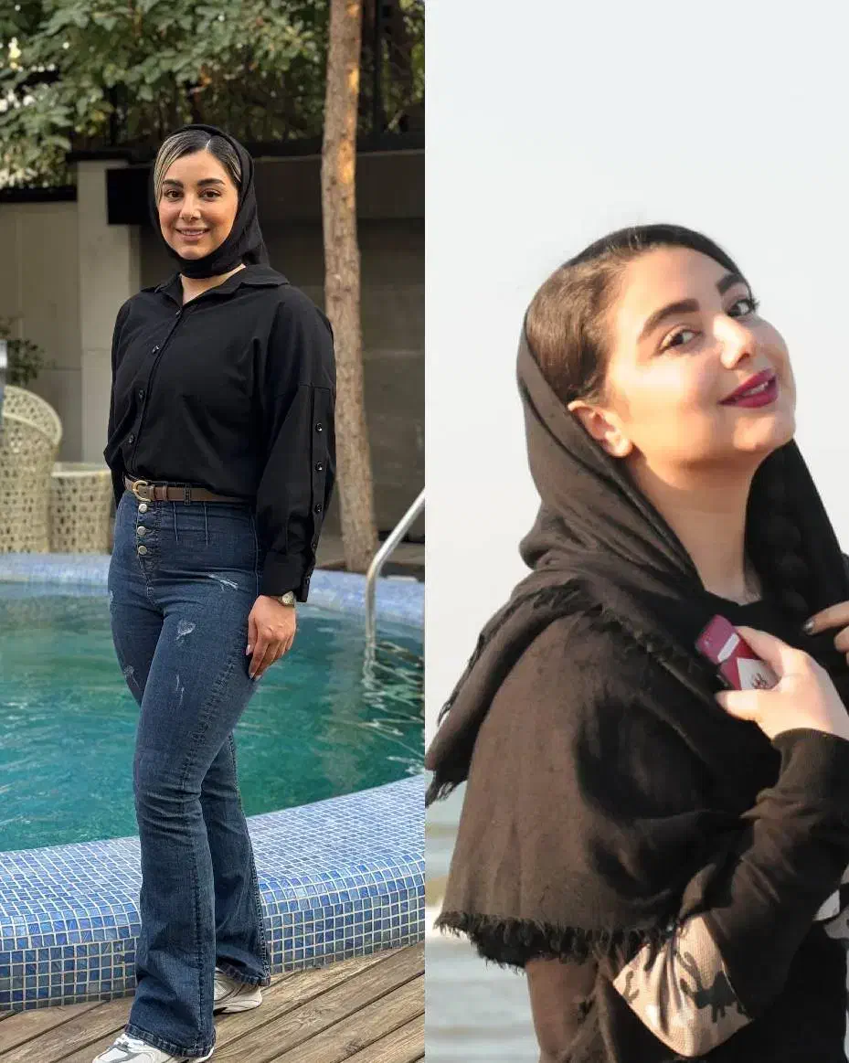 بوتاکس معده/تزریق لاغری/دستگاه لاغری|خدمات آرایشگری و زیبایی|تهران, دروس|دیوار