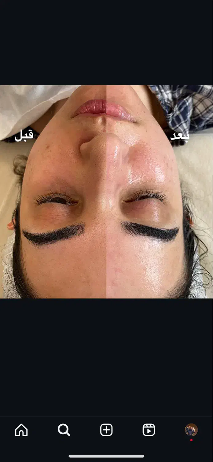 فیشال پوست برای خانمهاوآقایان|خدمات آرایشگری و زیبایی|کرمانشاه, |دیوار