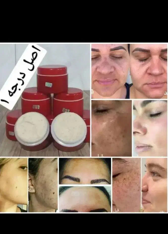 کرم معجزه اصل با گارانتی مرجوعی|آرایشی، بهداشتی، درمانی|سرپل ذهاب, |دیوار