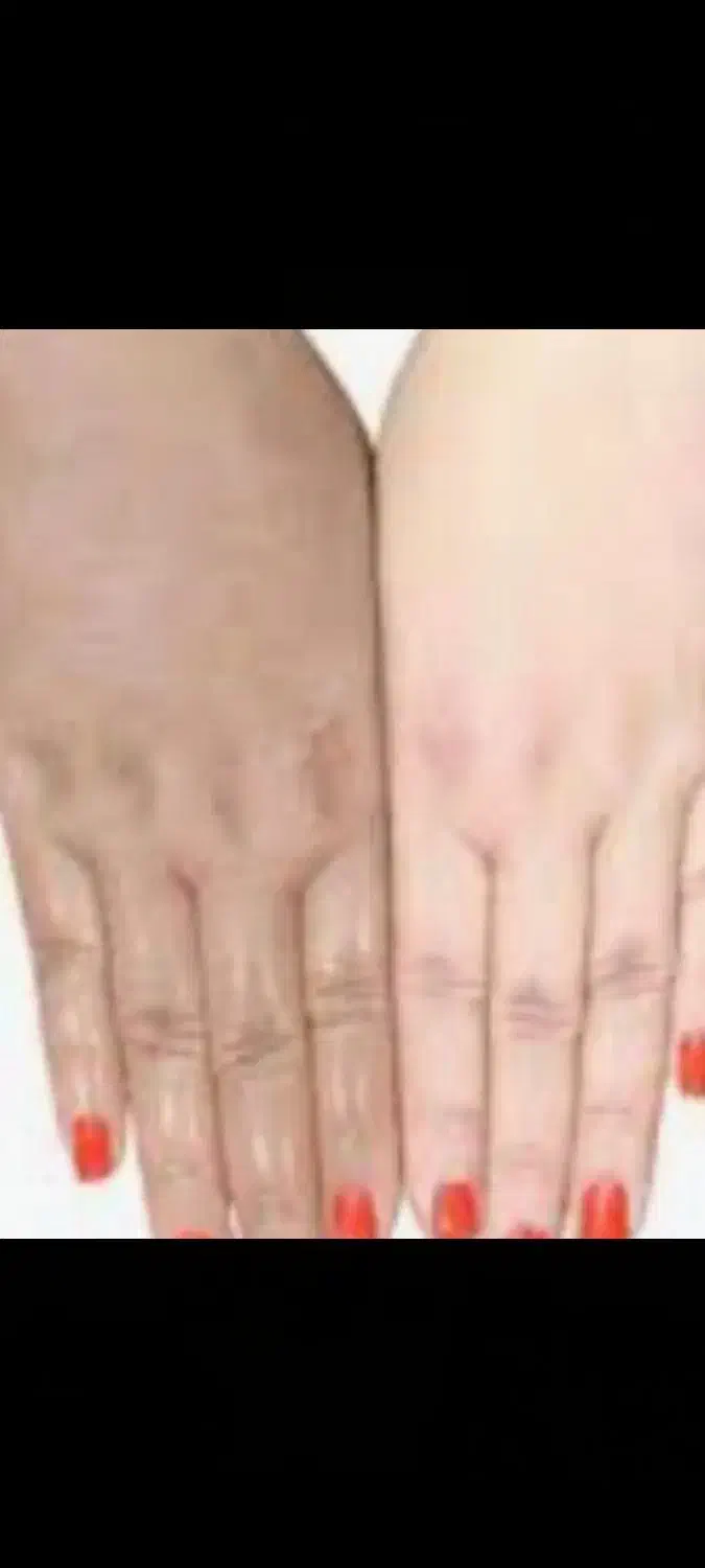 فرمول دست و پا و صورت|آرایشی، بهداشتی، درمانی|زابل, |دیوار