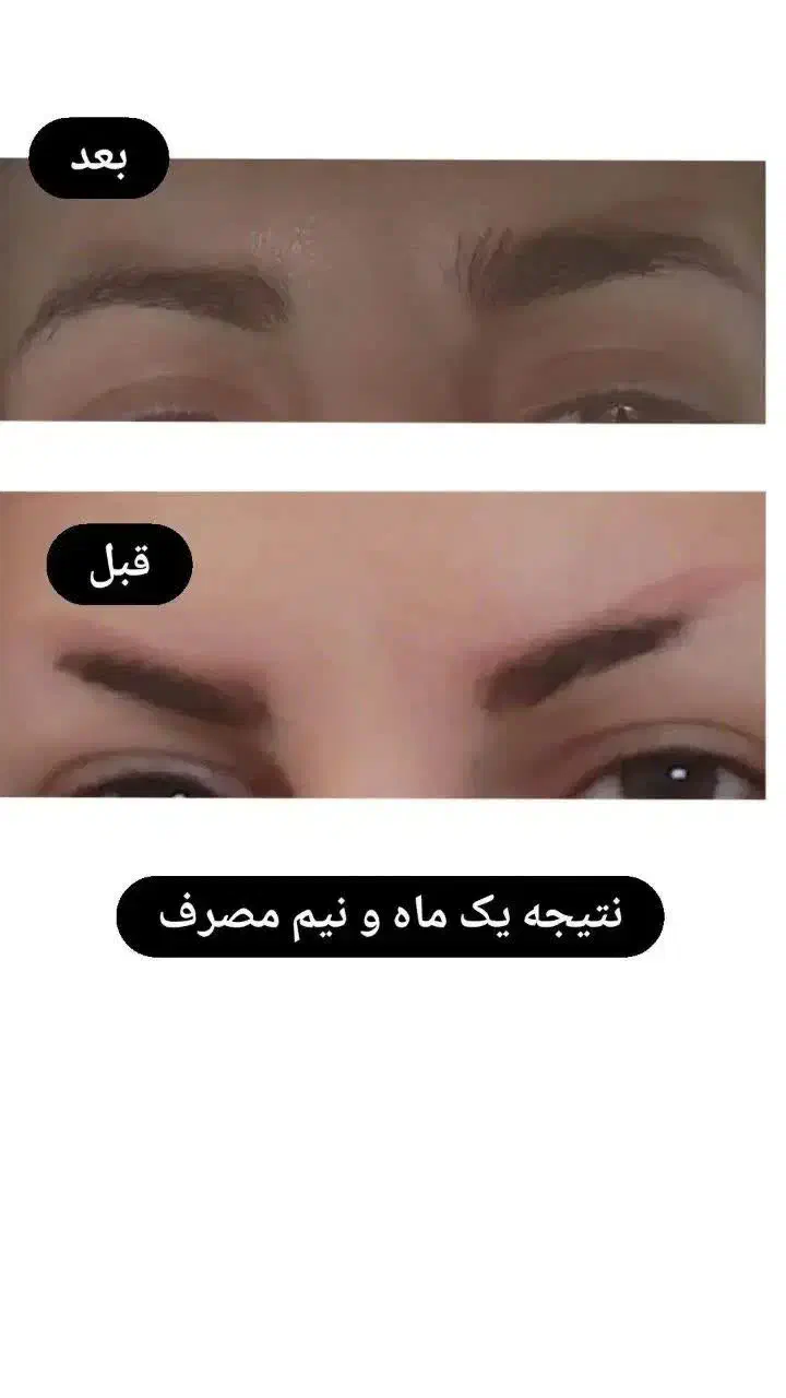 پوستتو با ما ترمیم کن|آرایشی، بهداشتی، درمانی|شیراز, ستارخان|دیوار