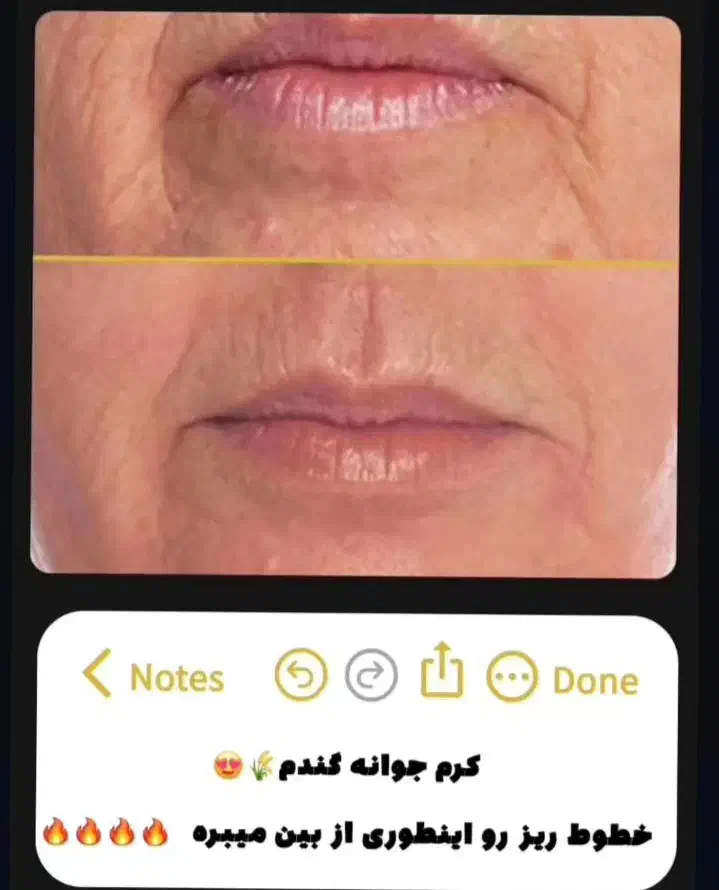 فروش میلیونی دریک روز|استخدام درمانی، زیبایی، بهداشتی|میاندوآب, |دیوار