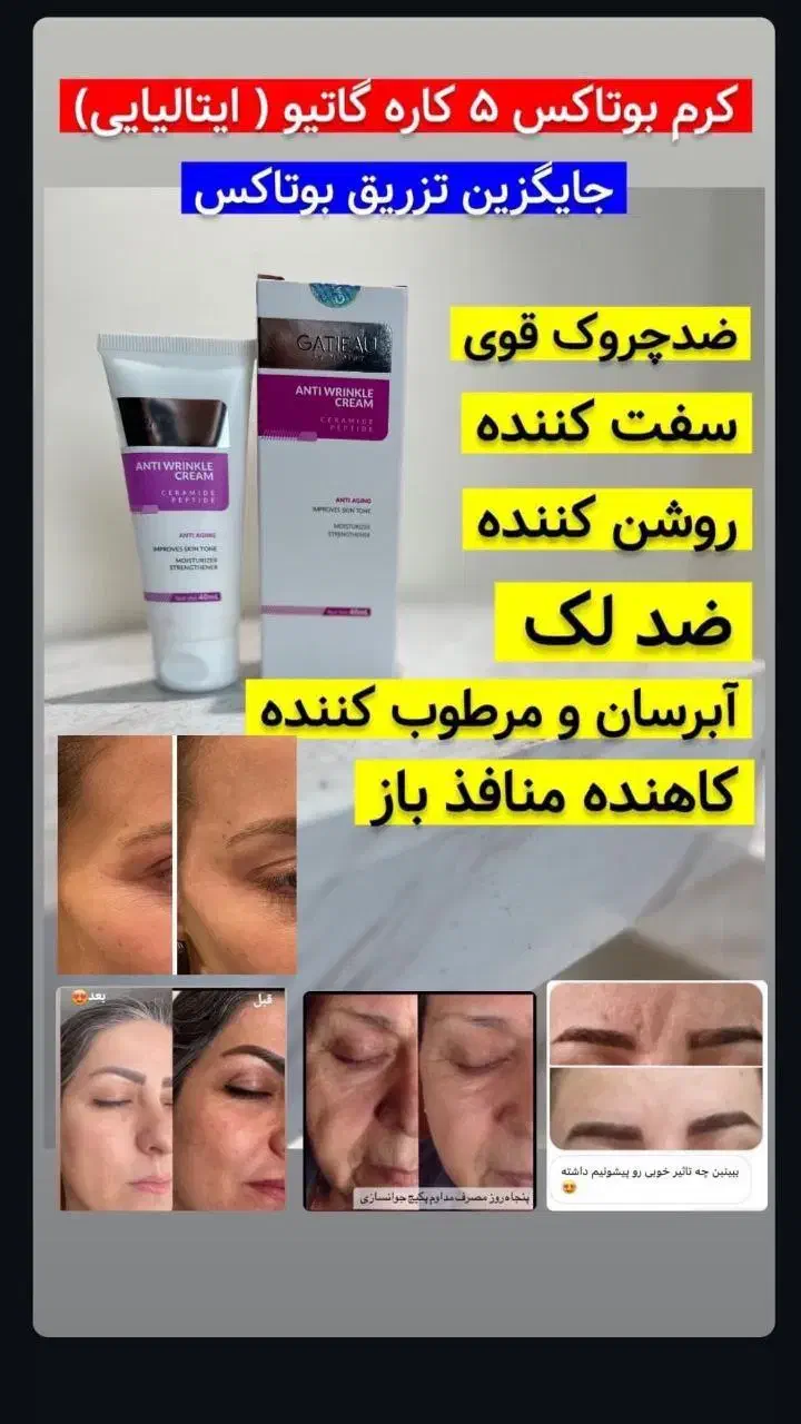 کرم پنج کاره بوتاکس گاتیو(ایتالیایی)|آرایشی، بهداشتی، درمانی|ماهنشان, |دیوار
