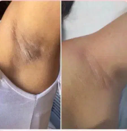 کرم رفع تیرگی تمام نقاط بدن|آرایشی، بهداشتی، درمانی|میناب, |دیوار