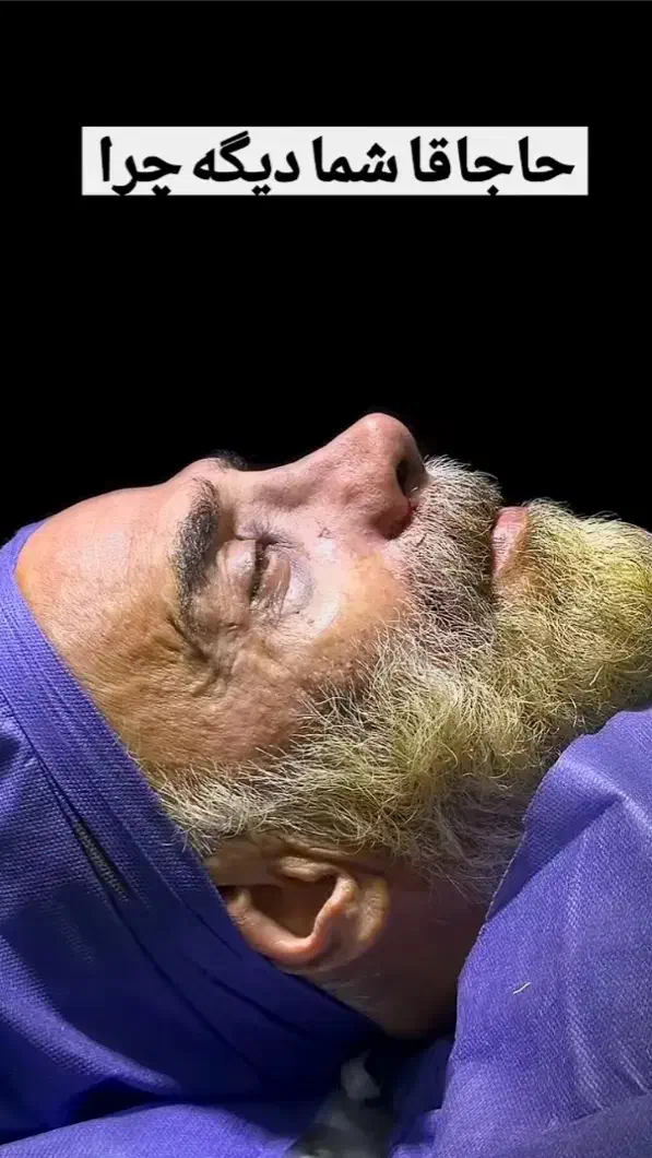 عمل بینی و جراحی لیپوساکشن با تیم پزشکان|خدمات آرایشگری و زیبایی|تهران, فلسطین (میدان انقلاب)|دیوار