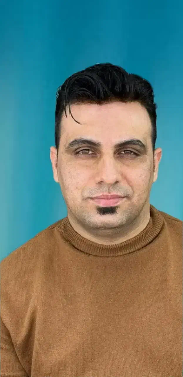 کاشت مو،ابرو،ریش|خدمات آرایشگری و زیبایی|بیرجند, |دیوار