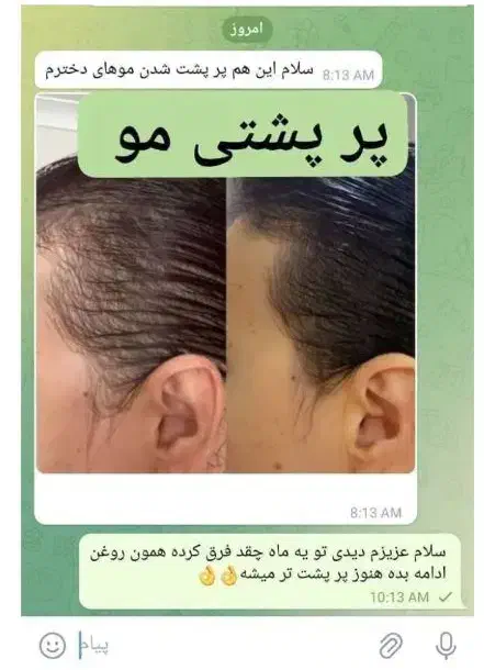 روغن پر پشتی مو مژه و ابرو|آرایشی، بهداشتی، درمانی|خنج, |دیوار