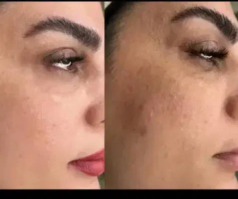 کرم معجزه گر|آرایشی، بهداشتی، درمانی|جیرفت, |دیوار