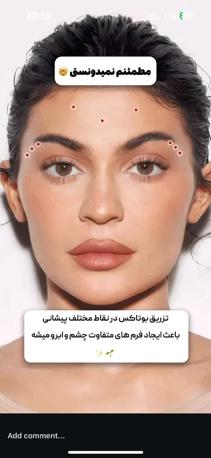 آموزش بوتاکس و فیلر (ژل)|خدمات آموزشی|امیدیه, |دیوار