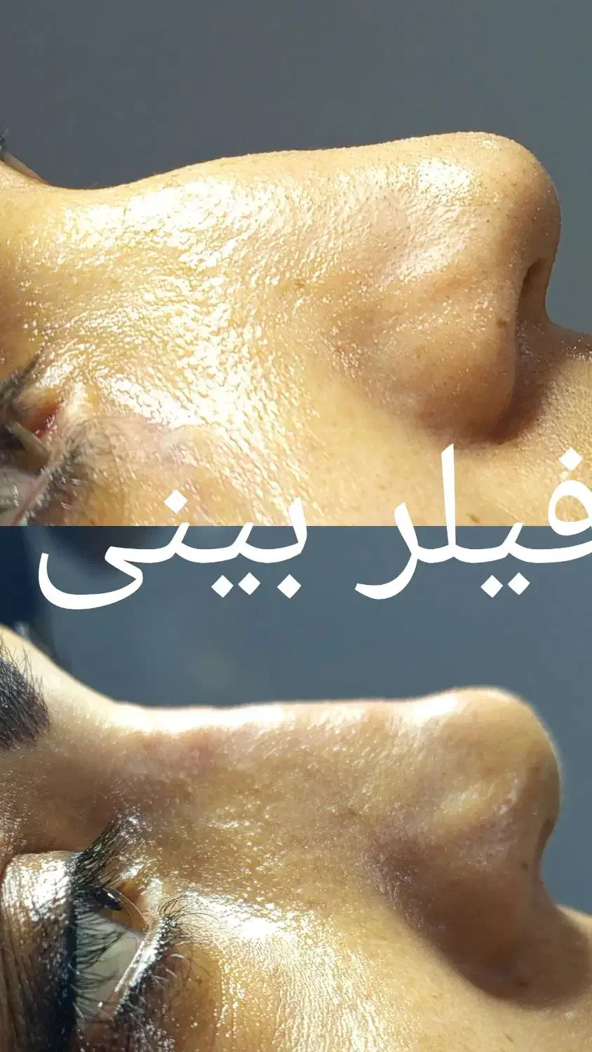 تخفیف ویژه خدمات زیبایی|خدمات آرایشگری و زیبایی|کوهدشت, |دیوار