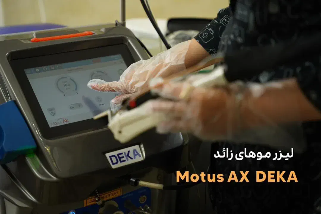 لیزر موهای زائد کل بدن فقط با 590|خدمات آرایشگری و زیبایی|کرمانشاه, |دیوار