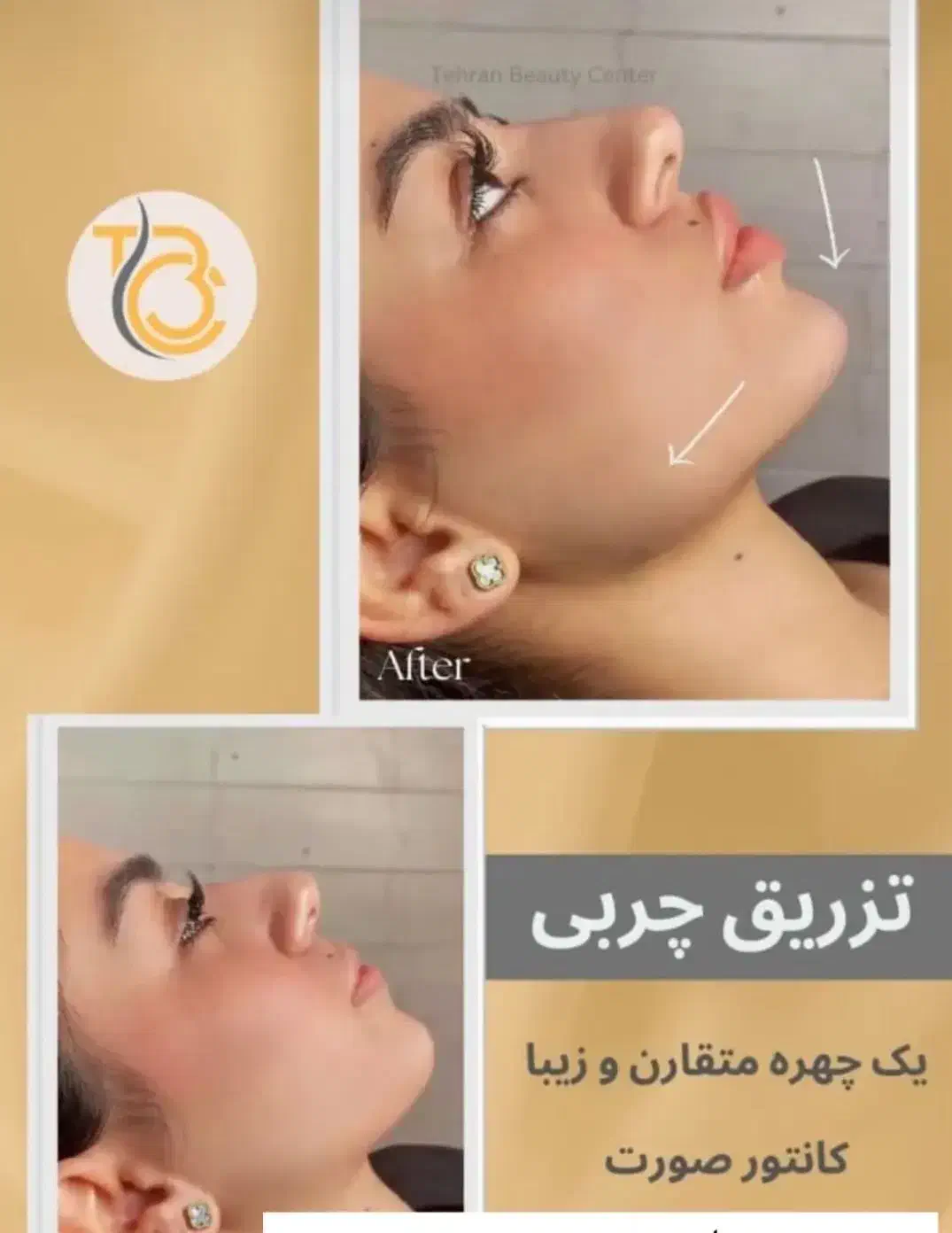 کاشت مو و ابرو / بوتاکس / چربی ژل /کلینیک /زیبایی|خدمات آرایشگری و زیبایی|بوکان, |دیوار