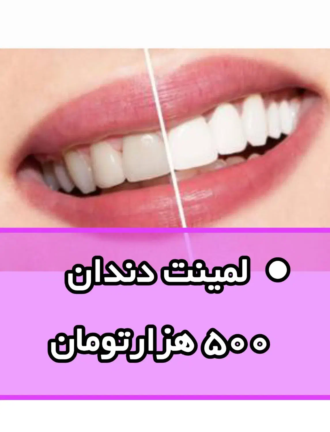 ان کا امOT|تخت و صندلی بچه|گرگان, |دیوار