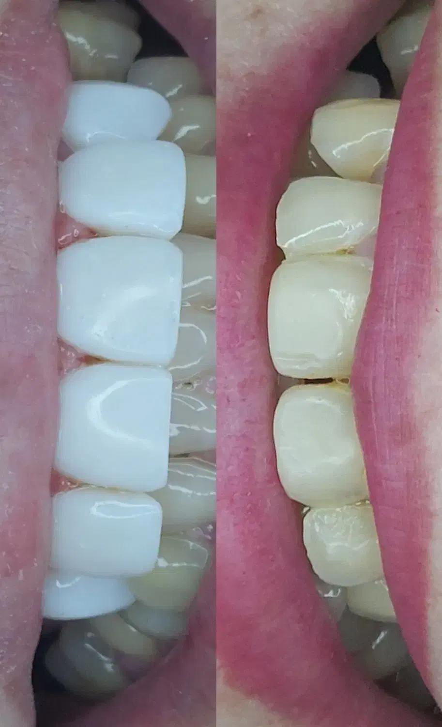 کامپوزیت زیبایی واحدی ۱،۶۰۰|خدمات آرایشگری و زیبایی|گرگان, |دیوار