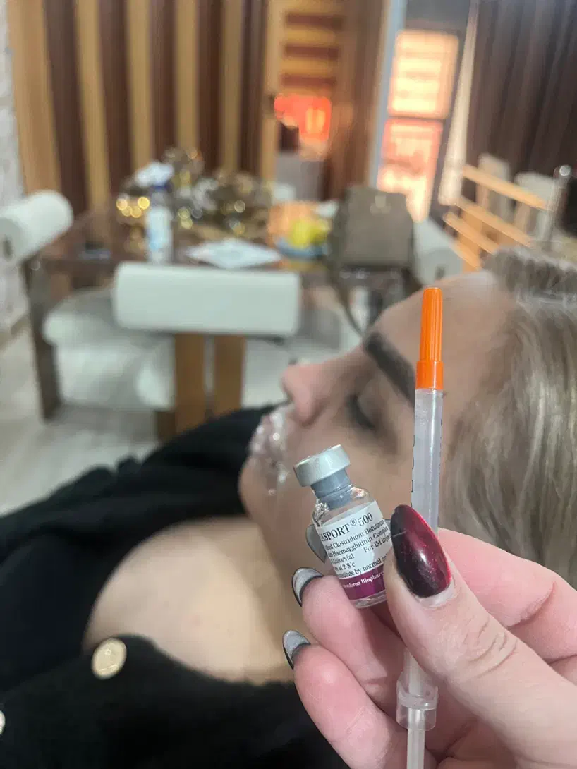 تخفیف ویژه یلدایی بوتاکس و‌فیلر(ژل)|خدمات آرایشگری و زیبایی|ارومیه, |دیوار