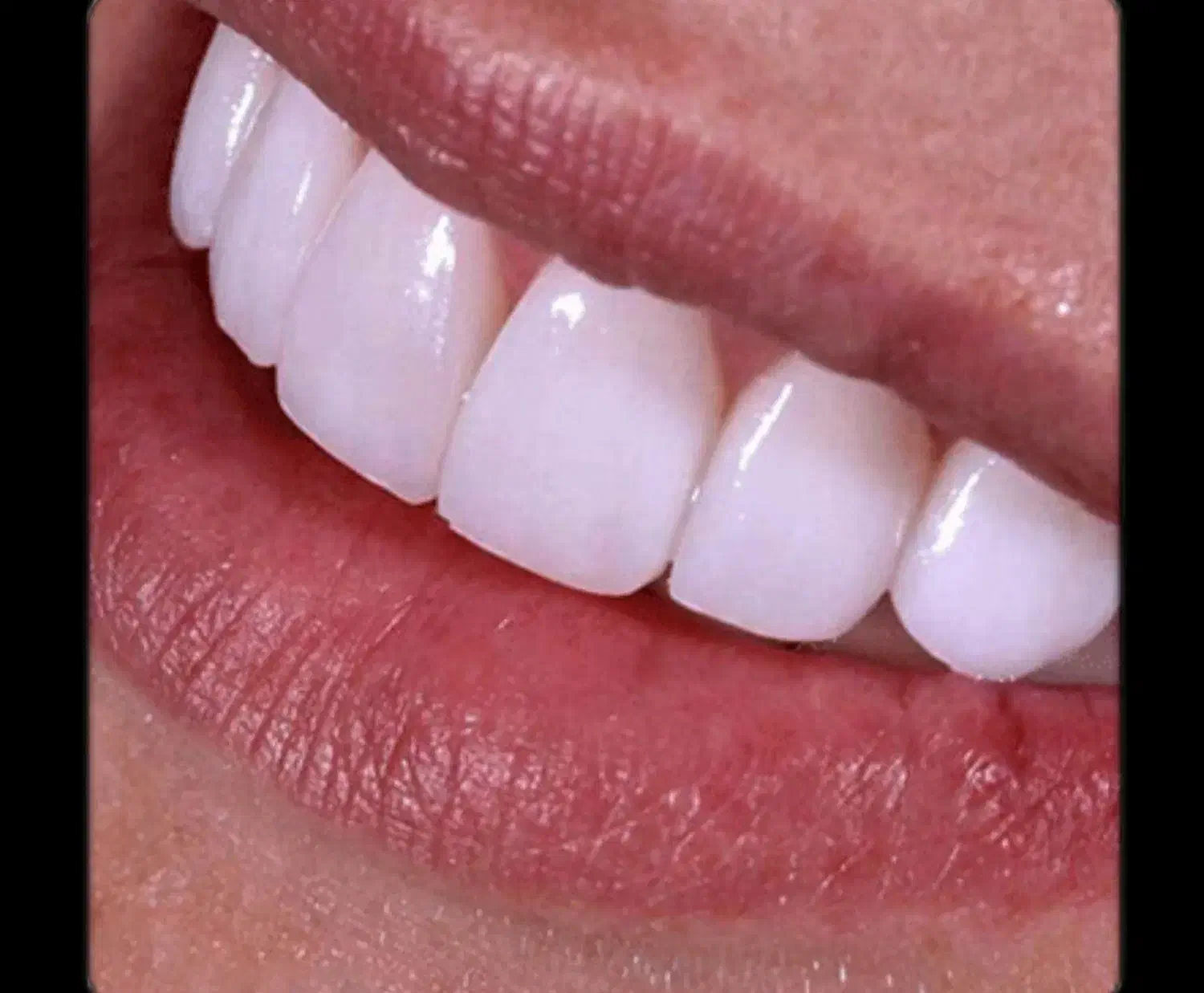 لابراتوار دندانسازی|استخدام درمانی، زیبایی، بهداشتی|الوند, |دیوار