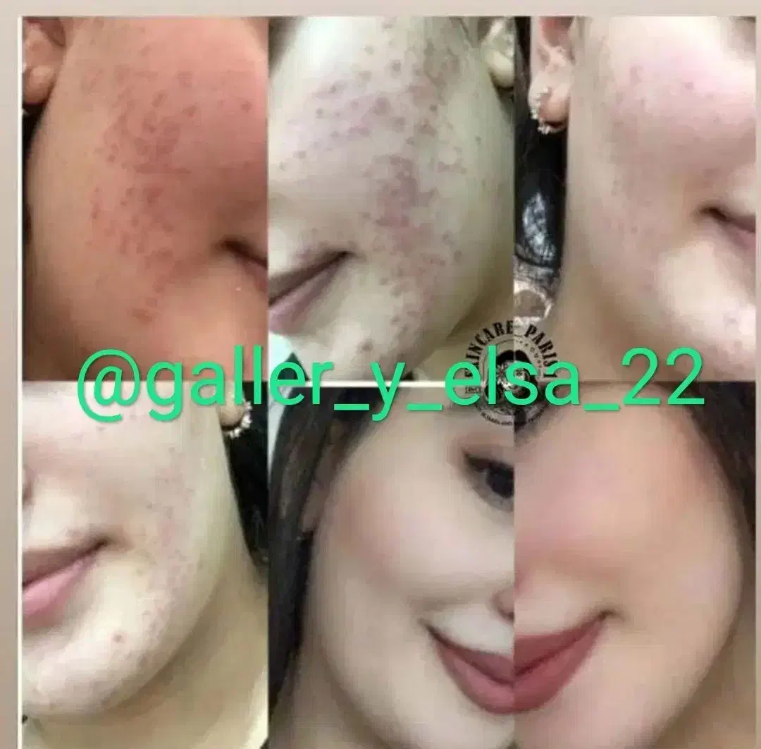 کرم سفید کننده صددرصد تضمینی|آرایشی، بهداشتی، درمانی|زابل, |دیوار