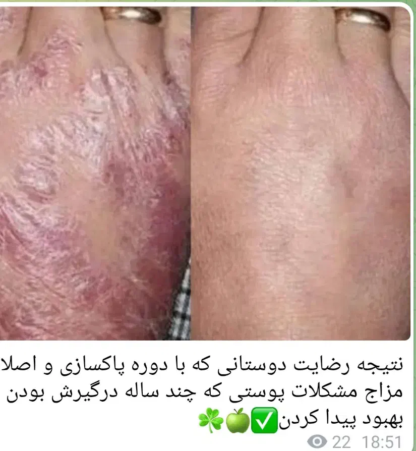 معجون|خوردنی و آشامیدنی|قلعه شاهین, |دیوار