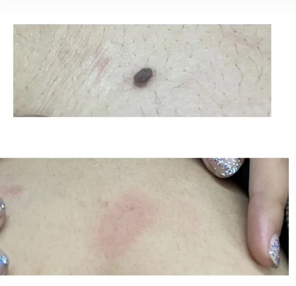 خال برداری و رفع کک ومک|خدمات آرایشگری و زیبایی|رشت, رودباری|دیوار