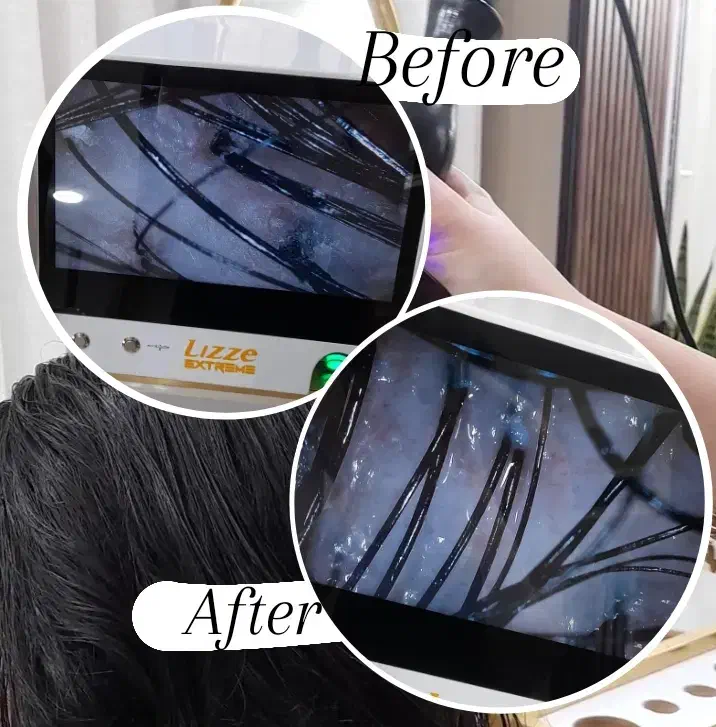 اسکراب‌اسکالپ(پاکسازی کف‌سر)+آنالیز ومشاوره رایگان|خدمات آرایشگری و زیبایی|کرج, باغستان|دیوار