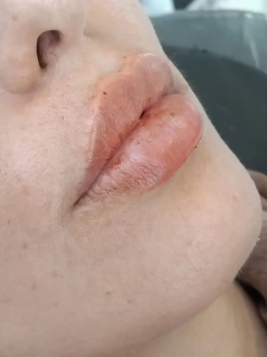 اموزش ژل بوتاکس و تمام خدمات مزو تراپی|خدمات آموزشی|مشهد, چهارچشمه|دیوار