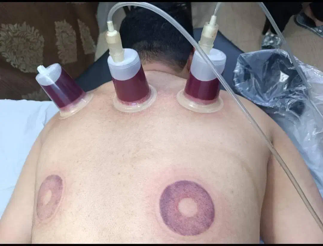 حجامت|خدمات آرایشگری و زیبایی|زاهدان, |دیوار