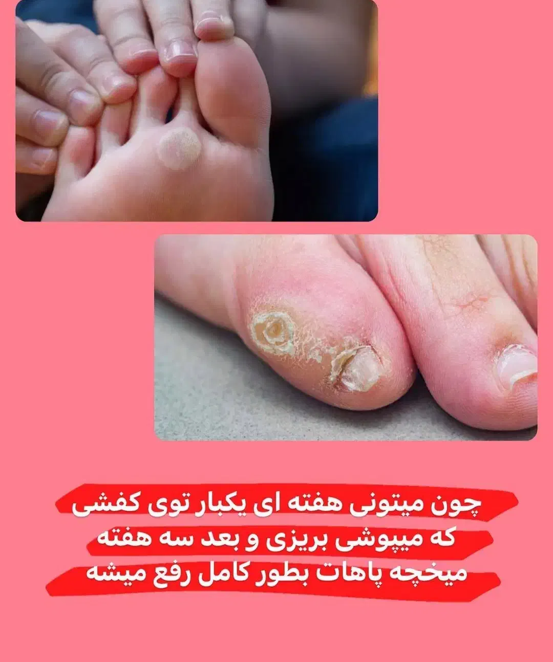 پودر عرق گیر ومخچه|آرایشی، بهداشتی، درمانی|سهند, |دیوار