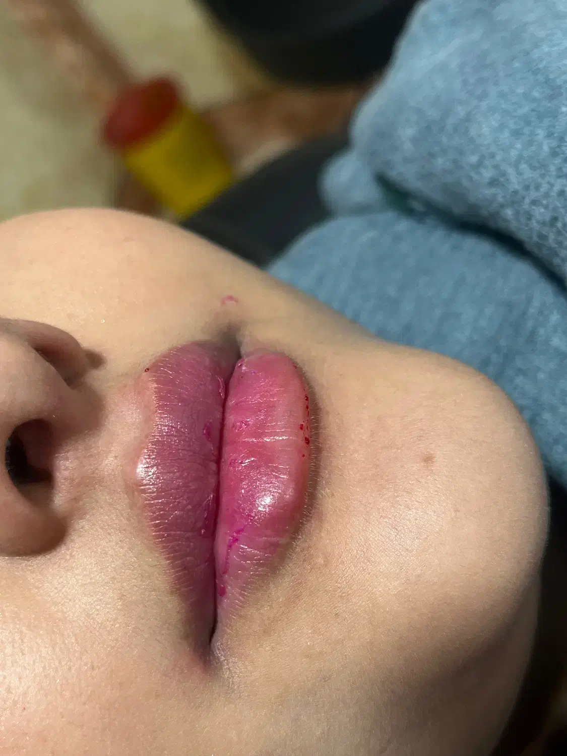 ژل بوتاکس|خدمات آرایشگری و زیبایی|دورود, |دیوار