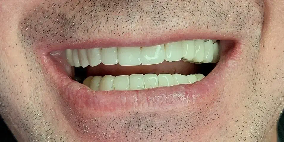 کامپوزیت زیبایی|خدمات آرایشگری و زیبایی|اسلامشهر, شهرک قائمیه|دیوار