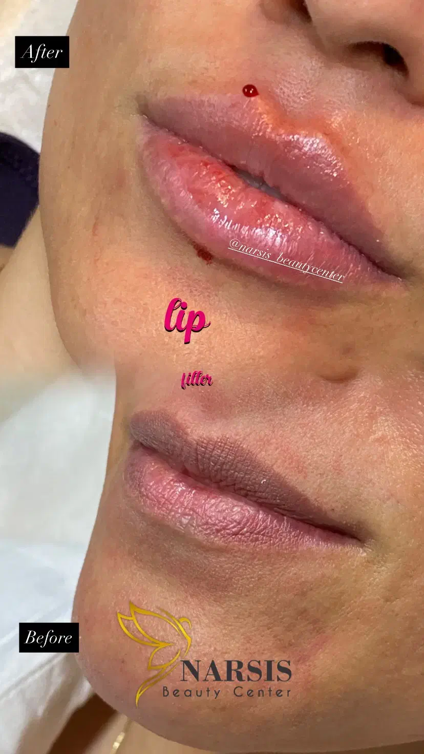 کلینیک پوست ، مو و لیزر|خدمات آرایشگری و زیبایی|شهریار, شهریار|دیوار