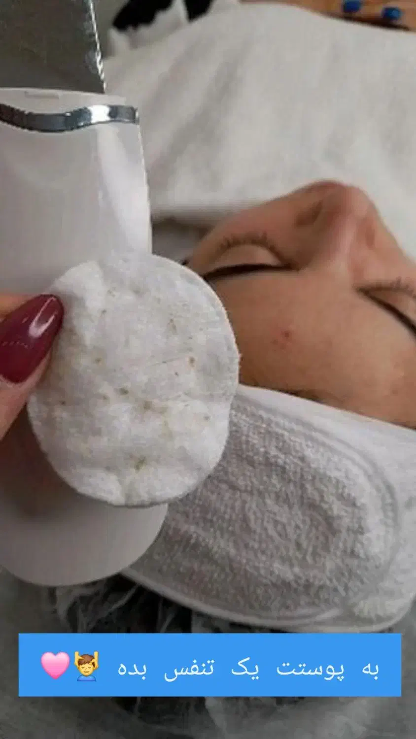 مدل فشیال و پاکسازی پوست بصورت حرفه ای|خدمات آرایشگری و زیبایی|مشهد, زیبا شهر|دیوار