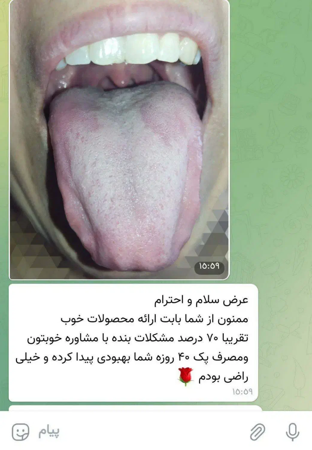 درمان بیماری با مشاوره ی زبان|فعالیت داوطلبانه|مشهد, ادیب نیشابوری (شهرک غرب)|دیوار