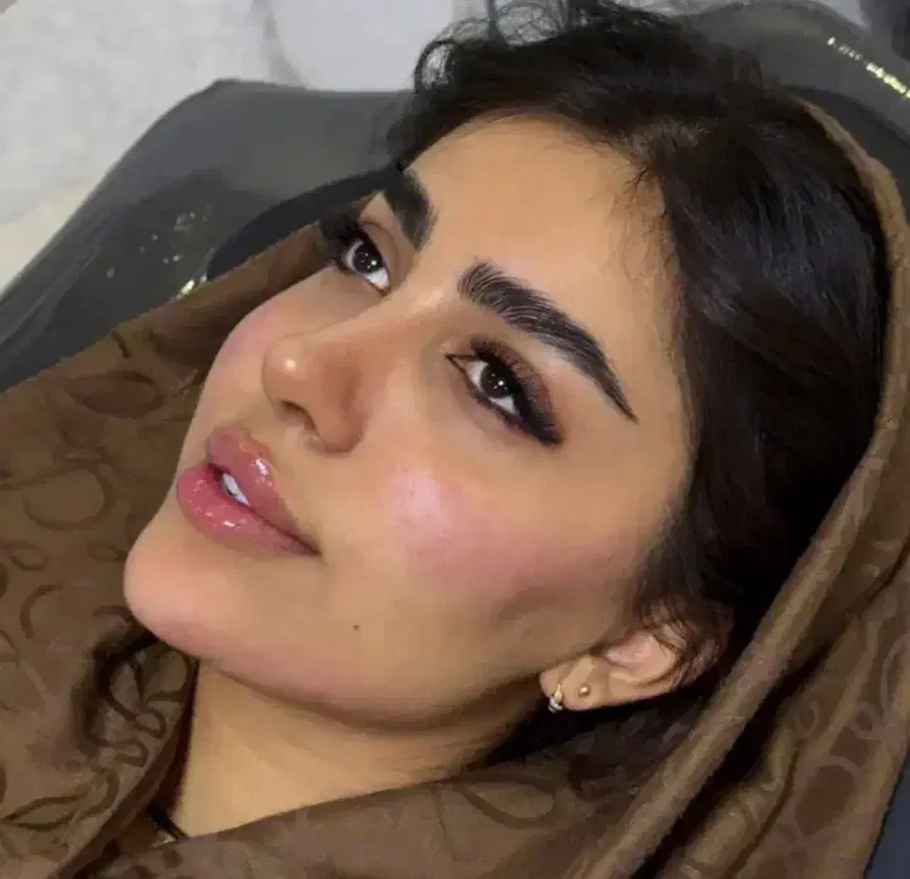 تزریق ژل فول فیس سی سی ۶۹۹|خدمات آرایشگری و زیبایی|اصفهان, خانه اصفهان|دیوار