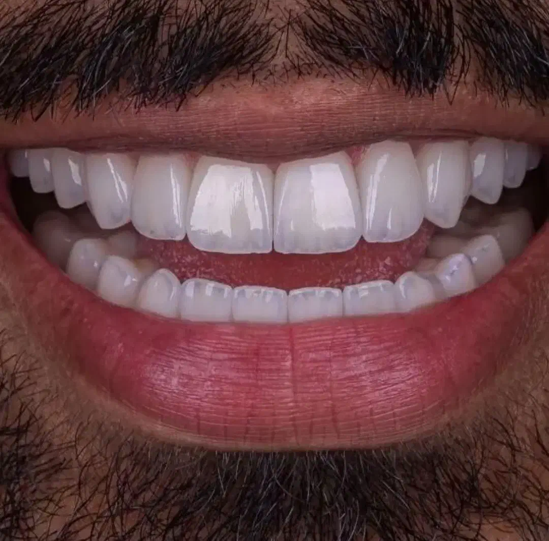 بالاترین کیفیت وارزانترین قیمت خدمات دندانپزشکی|خدمات آرایشگری و زیبایی|شیراز, سینما سعدی|دیوار