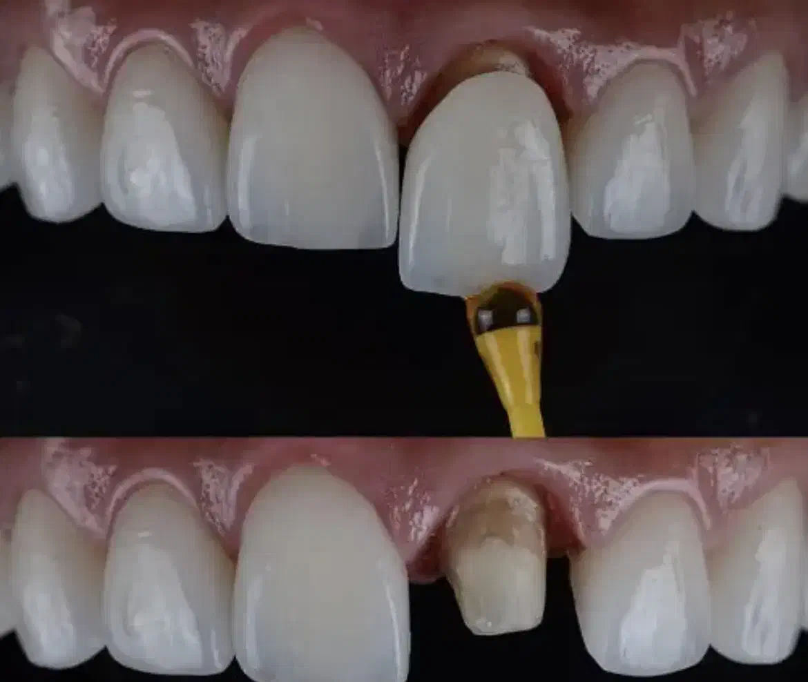 خدمات دندانپزشکی(روکش و کامپوزیت‌و..)|خدمات آرایشگری و زیبایی|گرگان, |دیوار