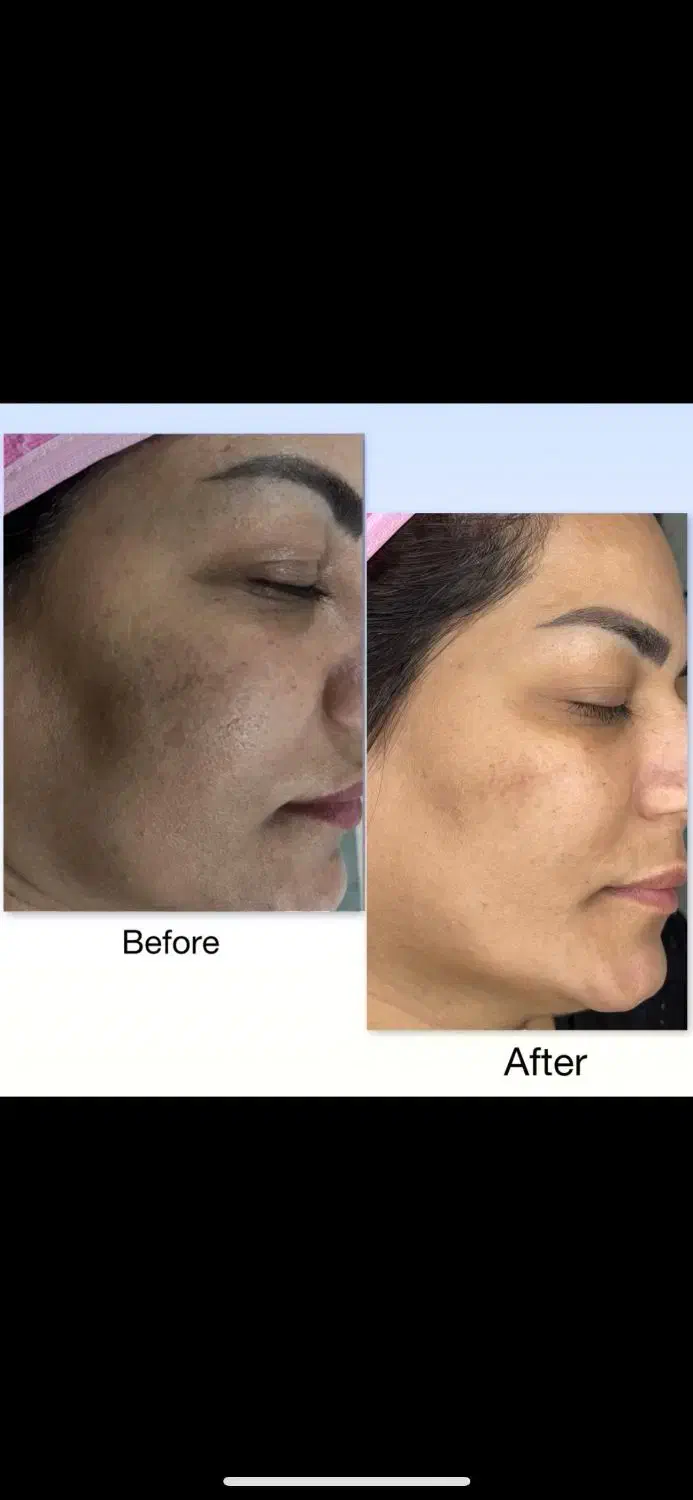 اصلاح|خدمات آرایشگری و زیبایی|دزفول, |دیوار