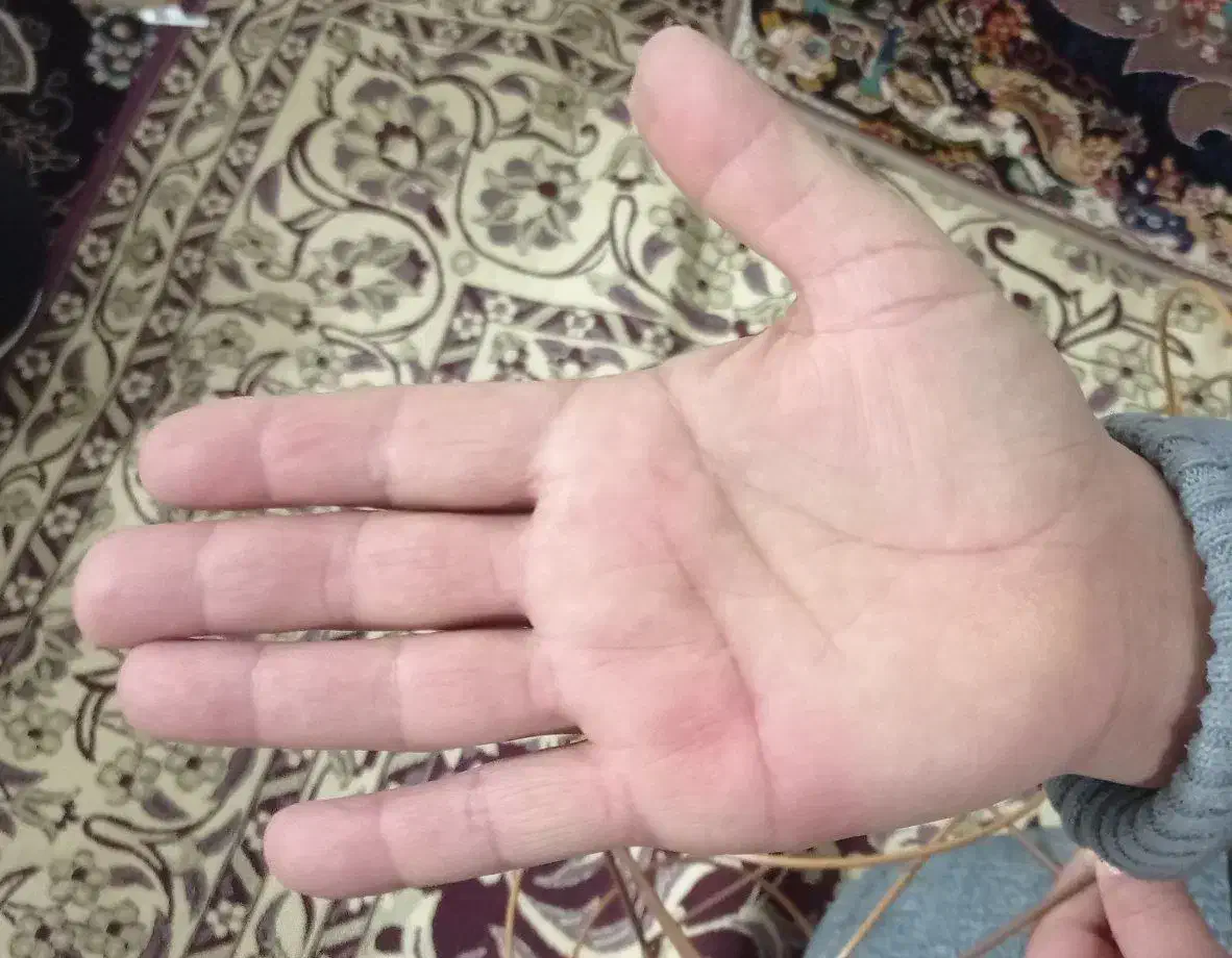 بیماری|خدمات آرایشگری و زیبایی|شیروان (خراسان), |دیوار