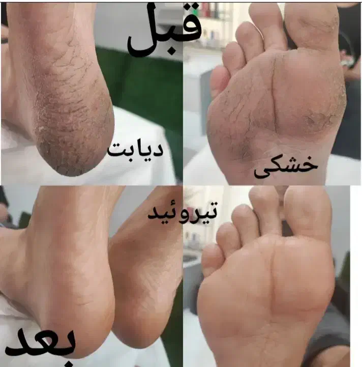 پدیکور و پاکسازی|خدمات آرایشگری و زیبایی|تربت‌حیدریه, شهید قرنی|دیوار