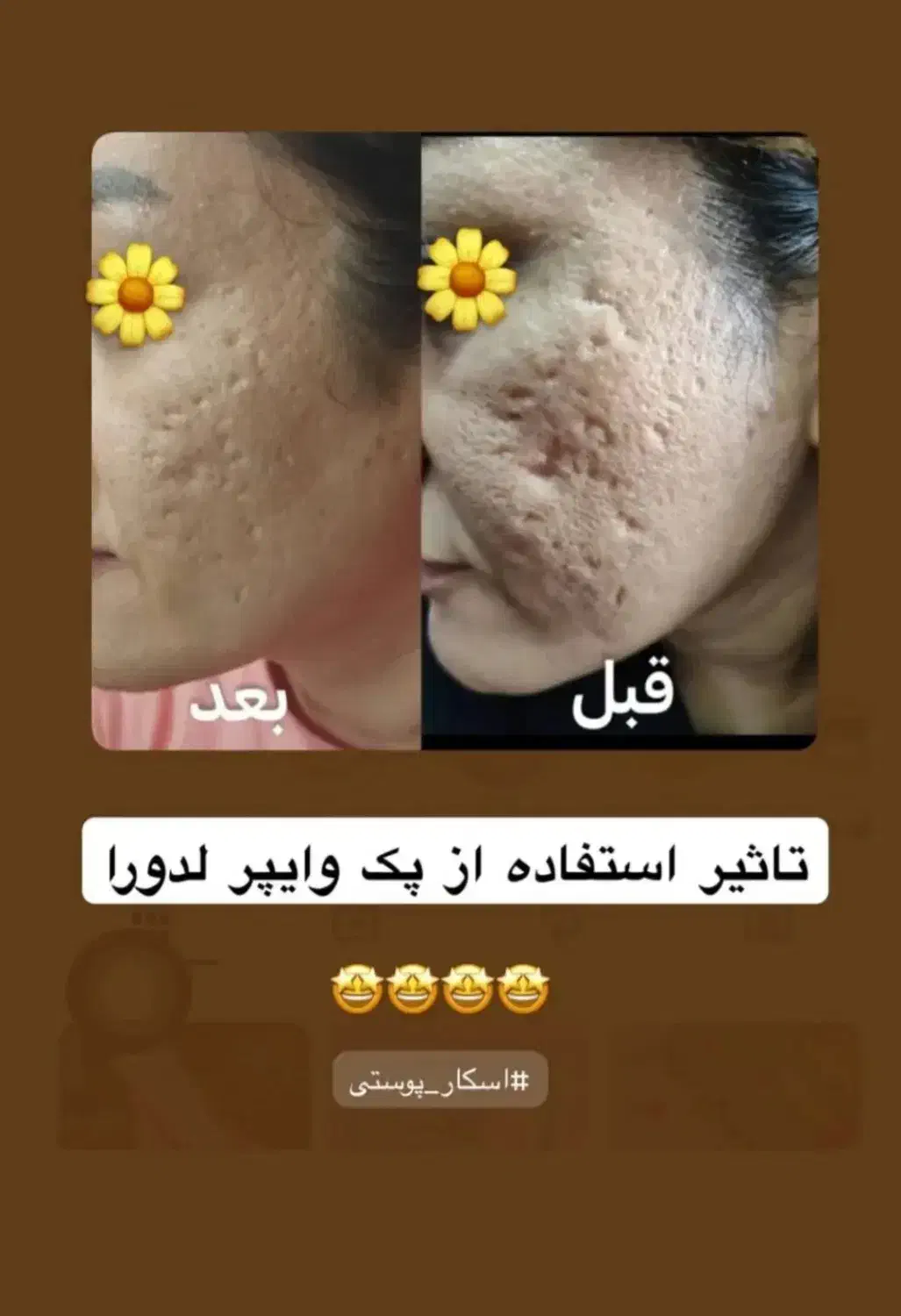 جوانسازی|آرایشی، بهداشتی، درمانی|شیراز, ابیوردی|دیوار