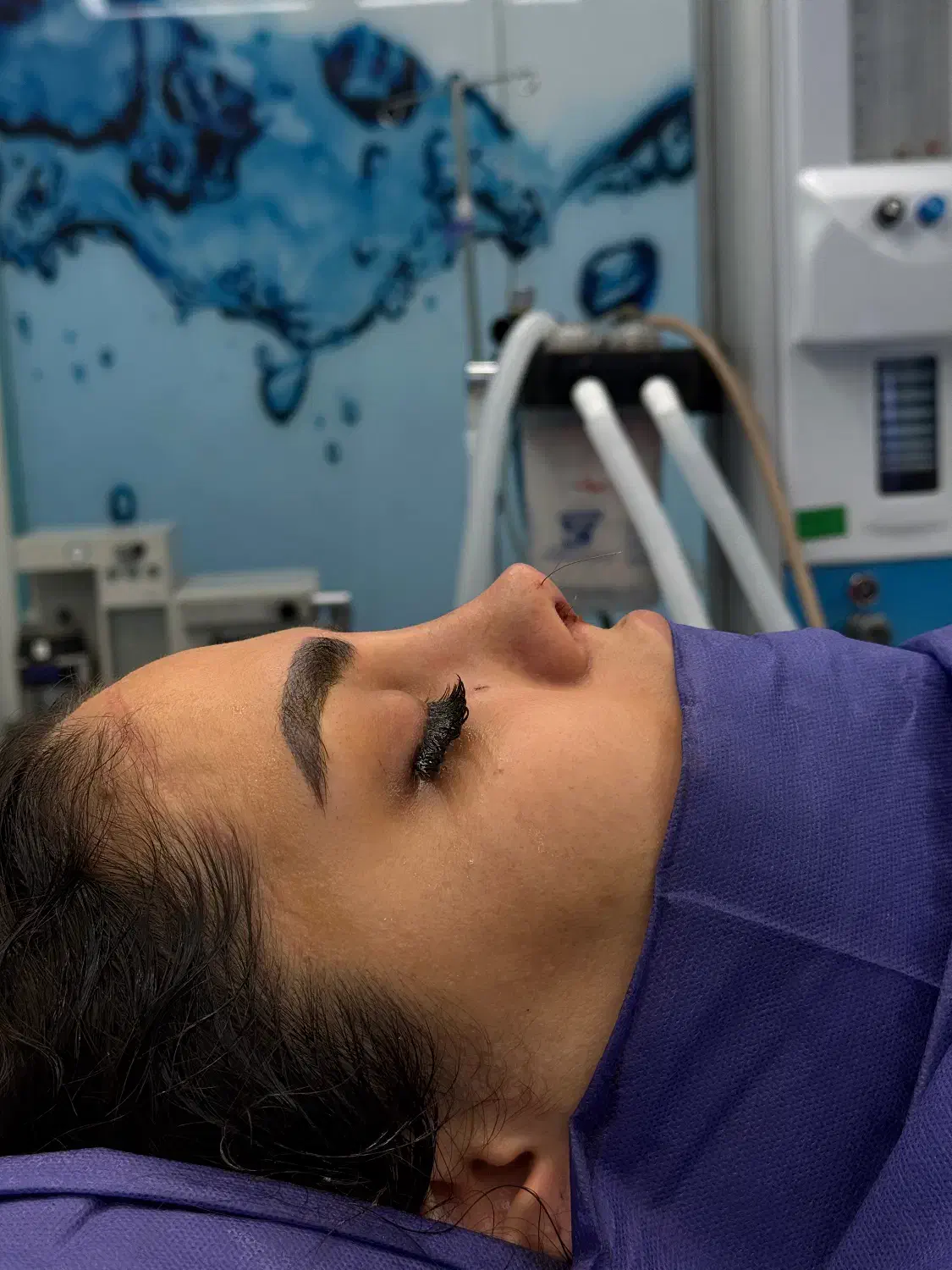 عمل بینی|خدمات آرایشگری و زیبایی|تهران, یوسفآباد|دیوار